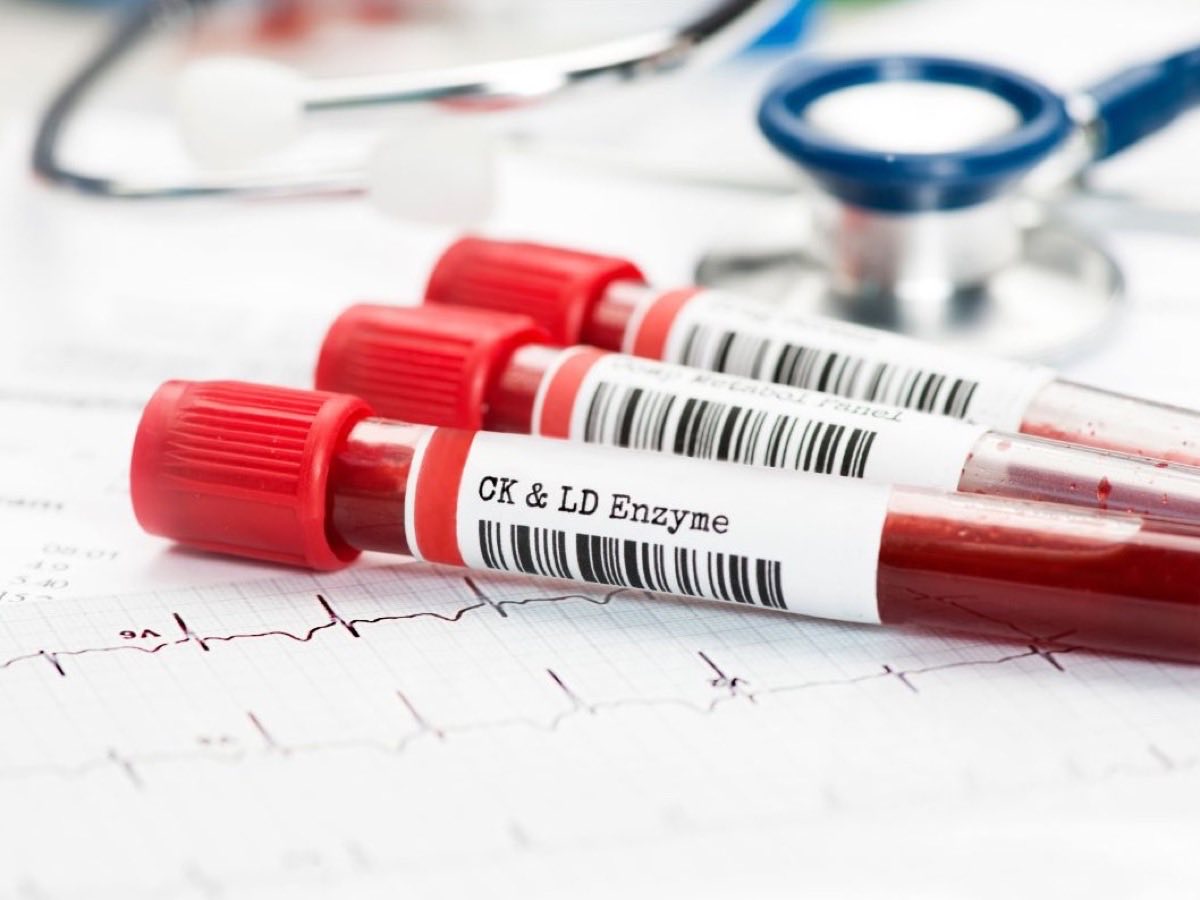 Labelled blood tubes on an ECG tracing beside a stethoscope — lab testing for Edinburg patients