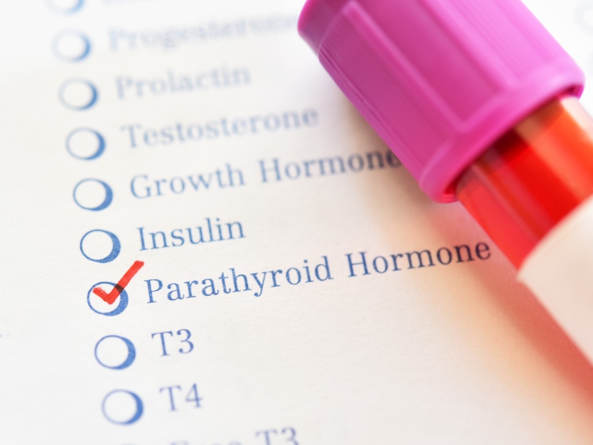 A hormone panel order form beside a blood sample tube — lab testing for San Juan patients