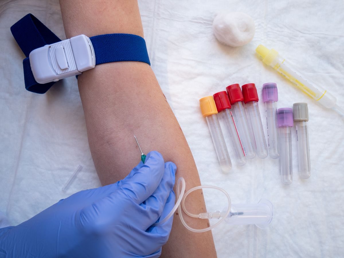 A blood draw in progress with a tourniquet on the arm and collection tubes laid out ready