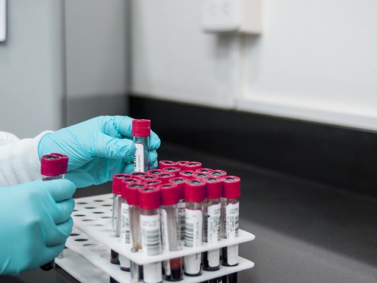 A gloved technician lifting a collected sample tube from a rack of blood tubes ready for routine panels