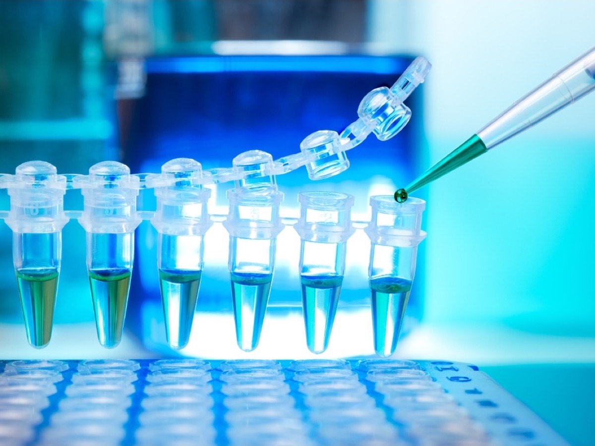 A pipette dispensing a sample into a row of PCR tubes during infectious disease testing