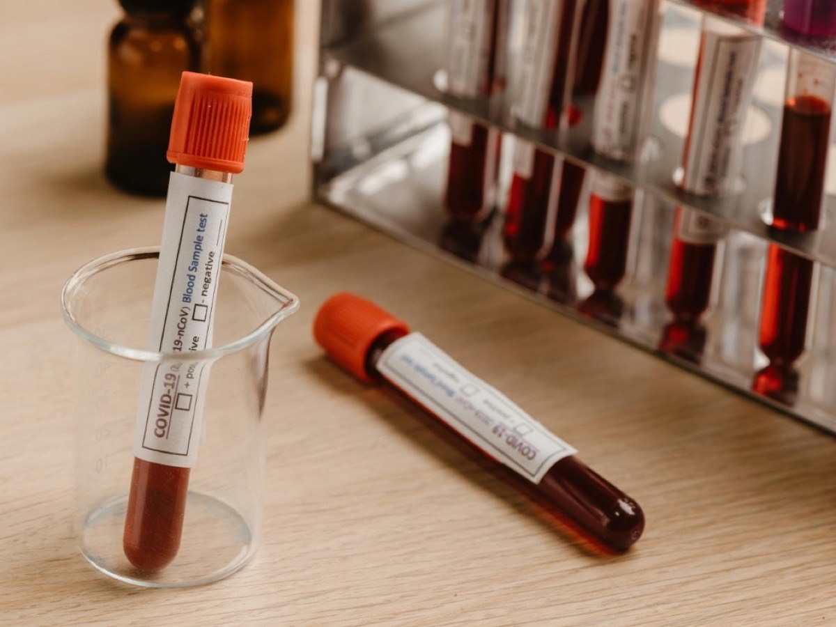 Labelled COVID-19 blood sample tubes beside a rack of collected specimens