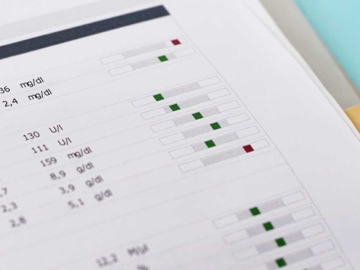 A printed lab result sheet showing measured values against reference ranges
