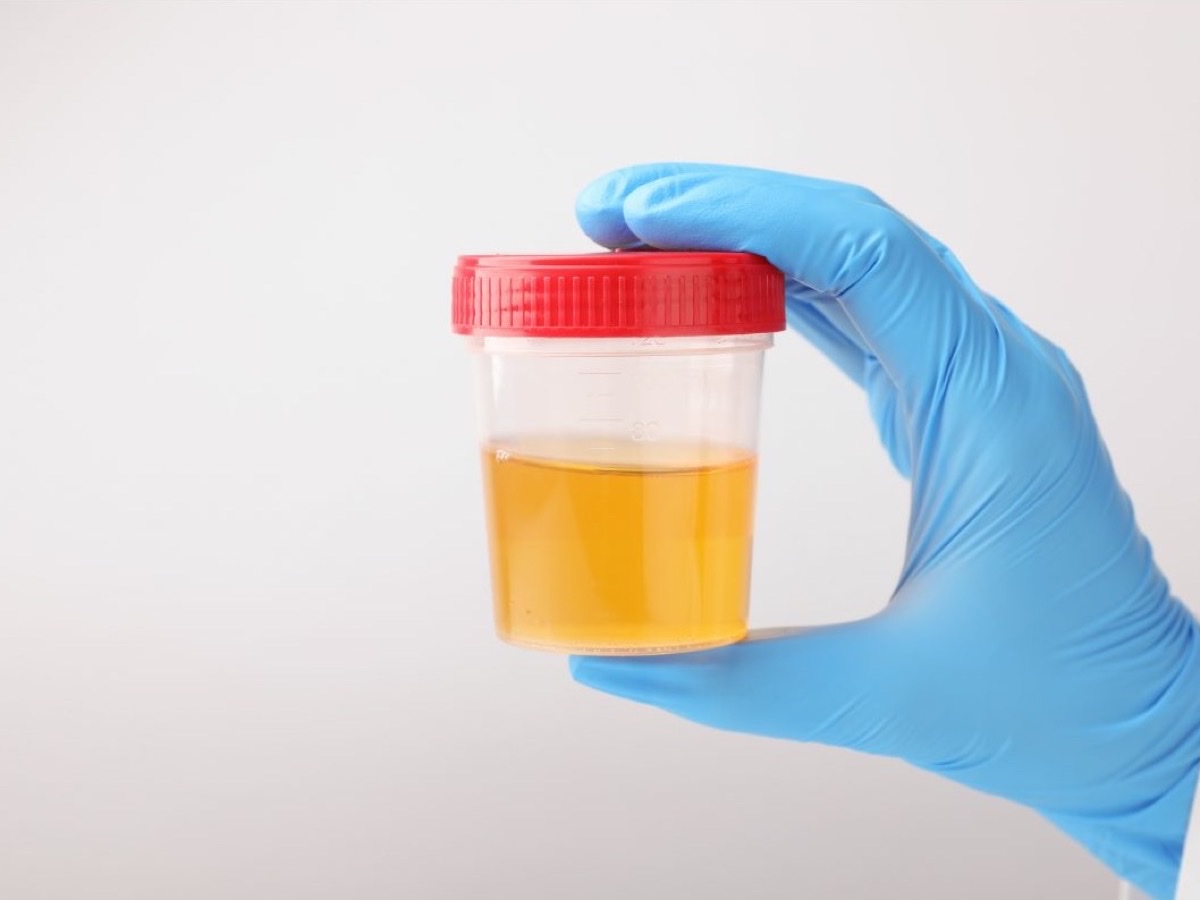 A gloved hand holding a sealed urine specimen cup for a drug screen