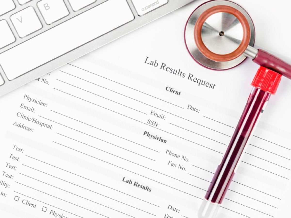 A blank lab results request form on a desk with a blood sample tube and stethoscope