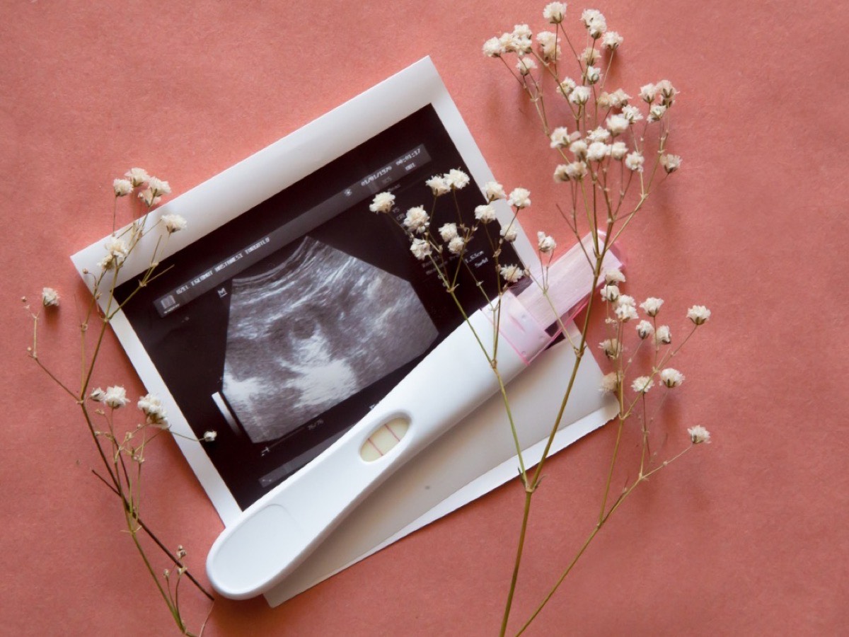 A positive pregnancy test and an ultrasound printout arranged with dried flowers