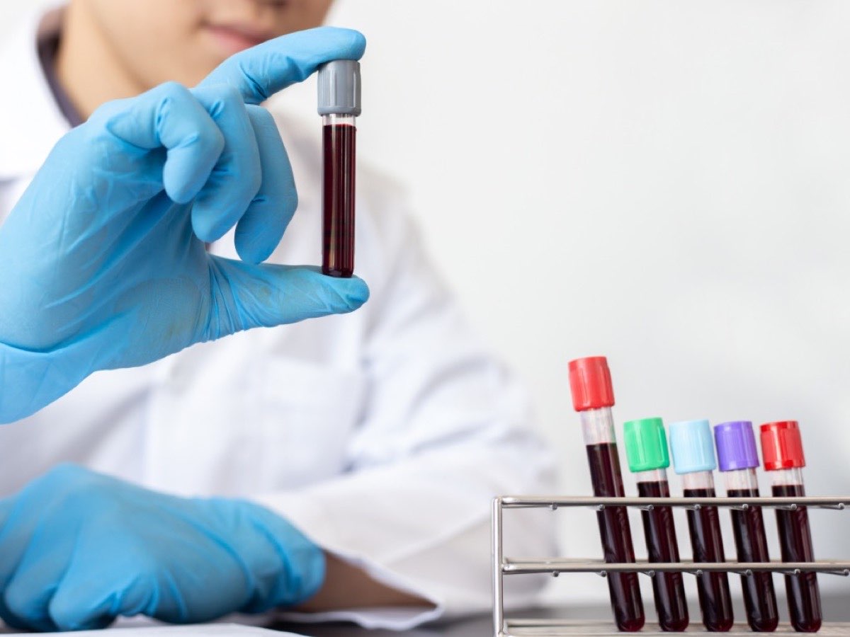 A lab technician holding up a collected blood sample tube beside a rack of filled tubes
