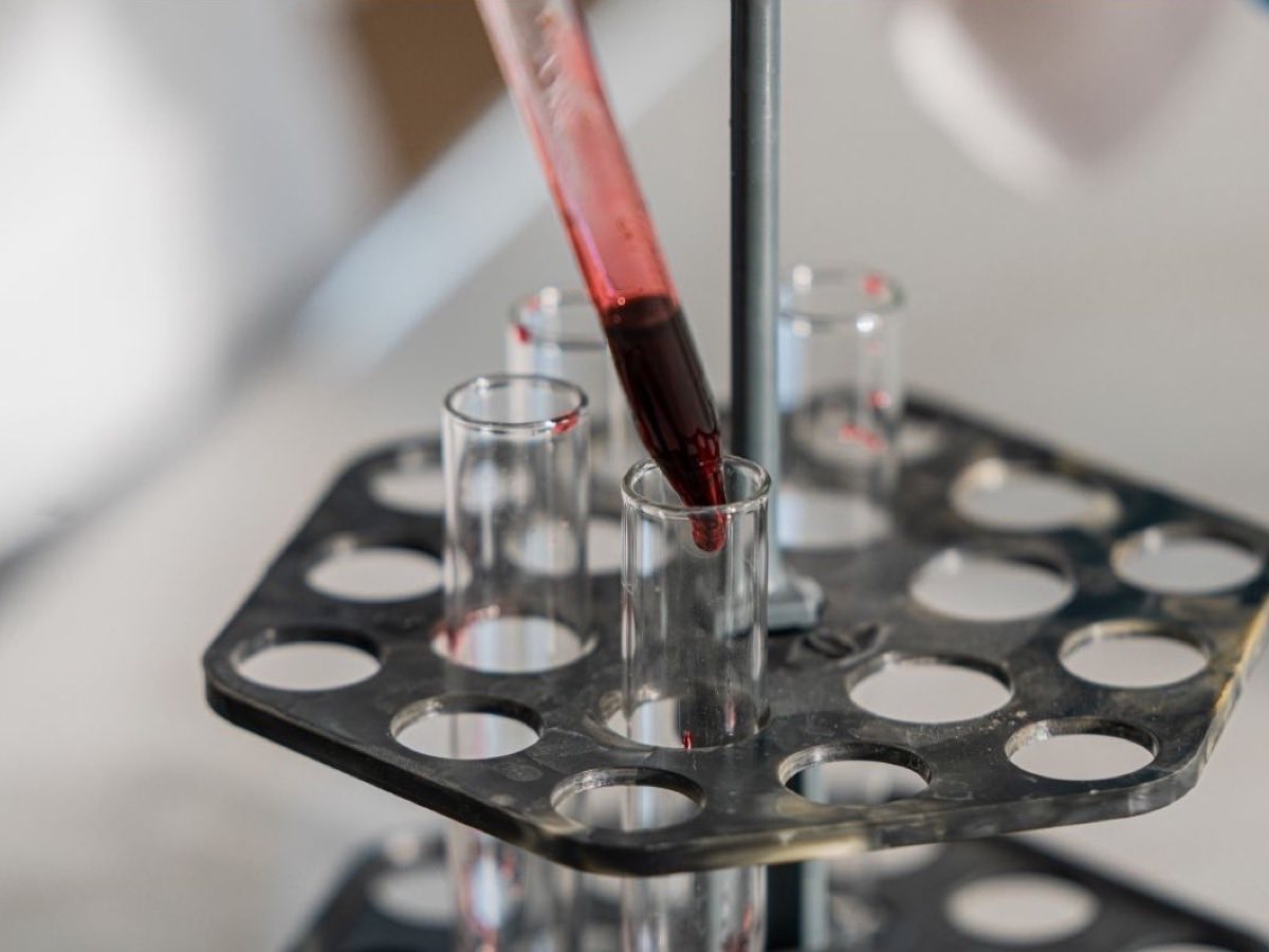 A pipette transferring a blood sample into a glass test tube for analysis