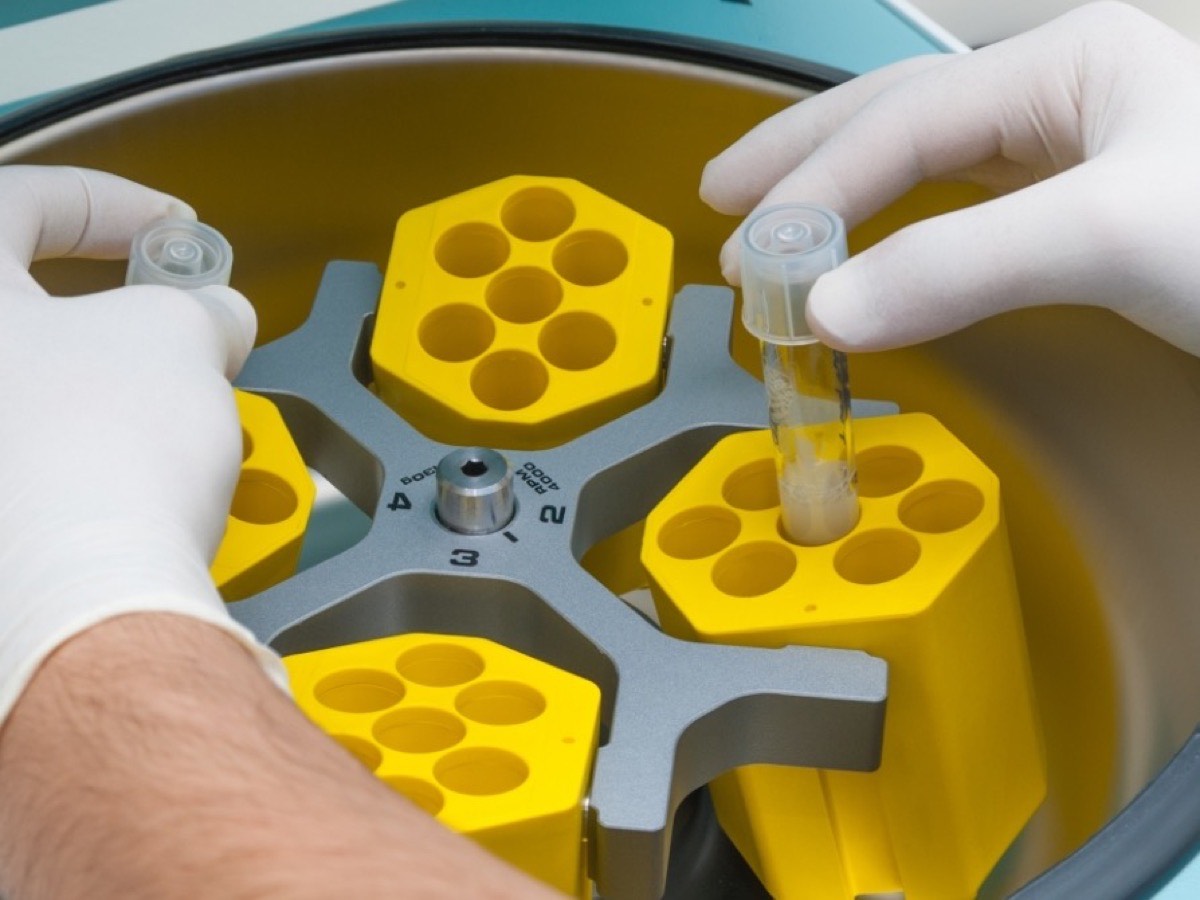 Gloved hands loading a sample tube into a centrifuge rotor for processing