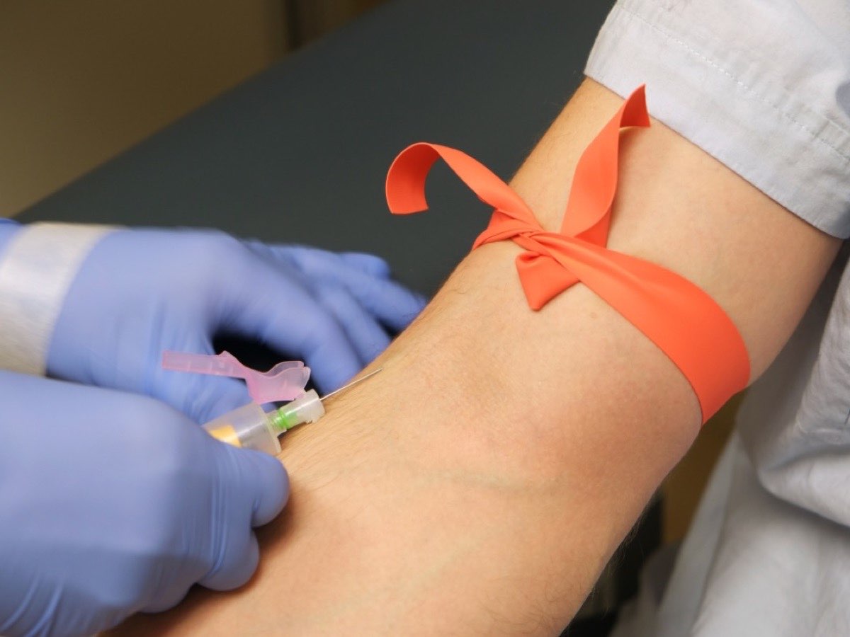 A blood draw being taken from a patient's arm with a tourniquet tied above the elbow